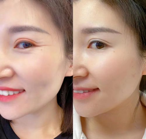 霜选择攻略指南效果出色的十大推荐AG真人网什么眼霜去皱效果好？眼(图10)